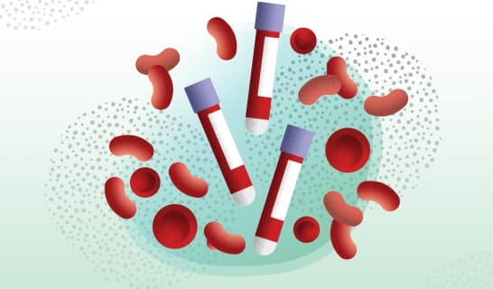 Detecting Cancer’s Methylation Fingerprint in Blood Plasma